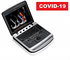 Chison SonoTouch 80