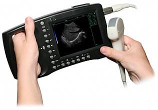 Medical Trade AcuVista RS880b